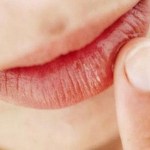 Bagaimana Cara Mengatasi Bibir Hitam Akibat Merokok Jadi Merah Secara Alami Dan Cepat