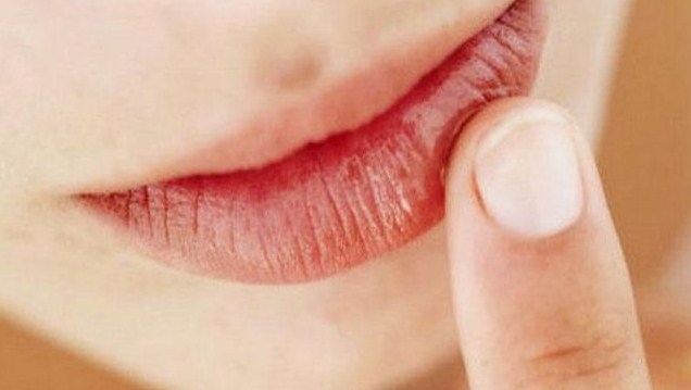bagaimana cara mengatasi bibir hitam akibat merokok jadi merah secara alami dan cepat