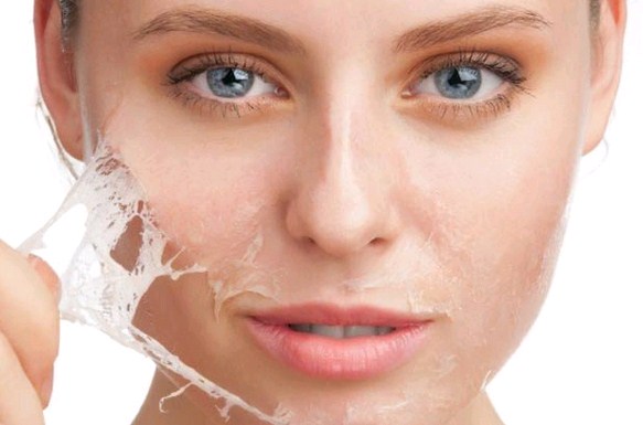 cara mengatasi kulit kering dan bersisik pada wajah secara alami